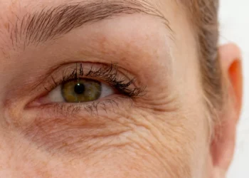 Envelhecimento: A razão pela qual a sua pele enruga com o passar dos anos